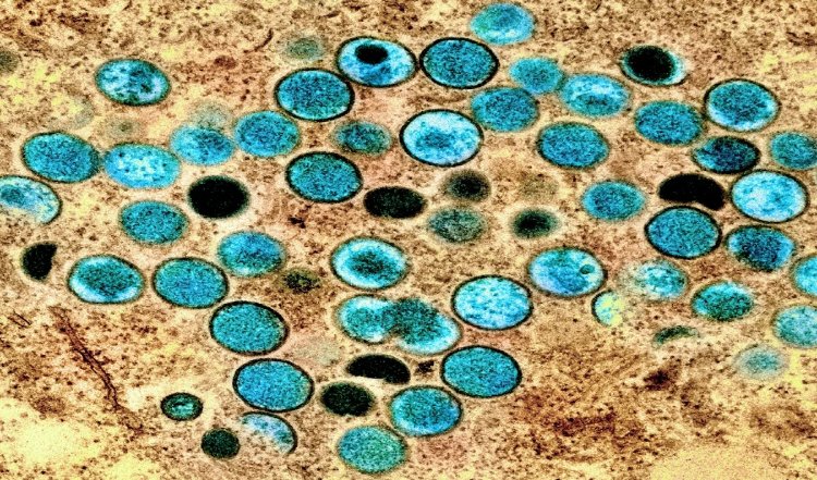 अब भारत में होगी Monkey Pox की जांच, डिटेक्शन के लिए विकसित हुई RT-PCR किट