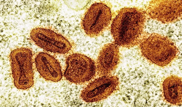 भारत में सामने आया Mpox का मामला, जानें इसके लक्षण, बचाव का तरीका और वैक्सीन के बारे में
